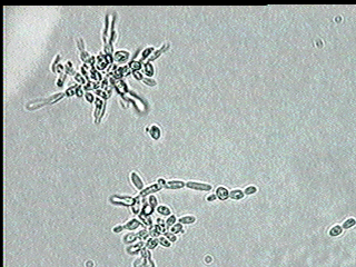 Грибок Candida parapsilosis 