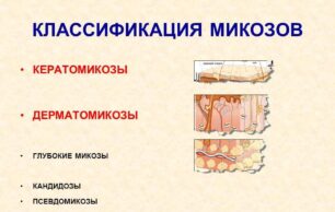 Как происходит лечение грибка на лице?