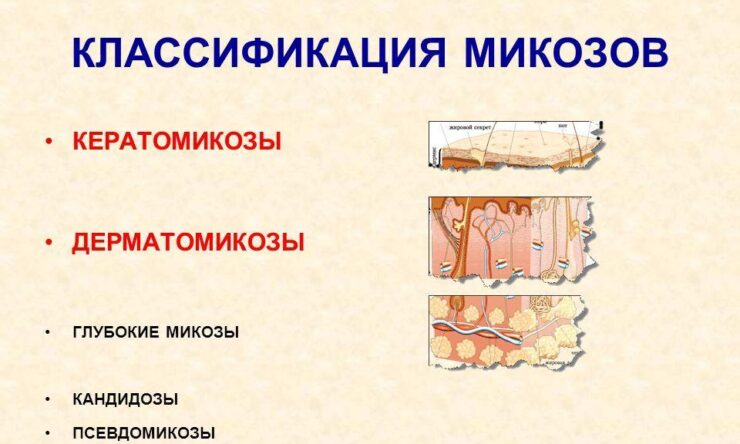 Как происходит лечение грибка на лице?