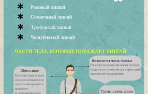 Как передается и лечится лишай?